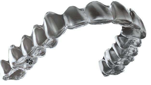 Invisalign clear braces