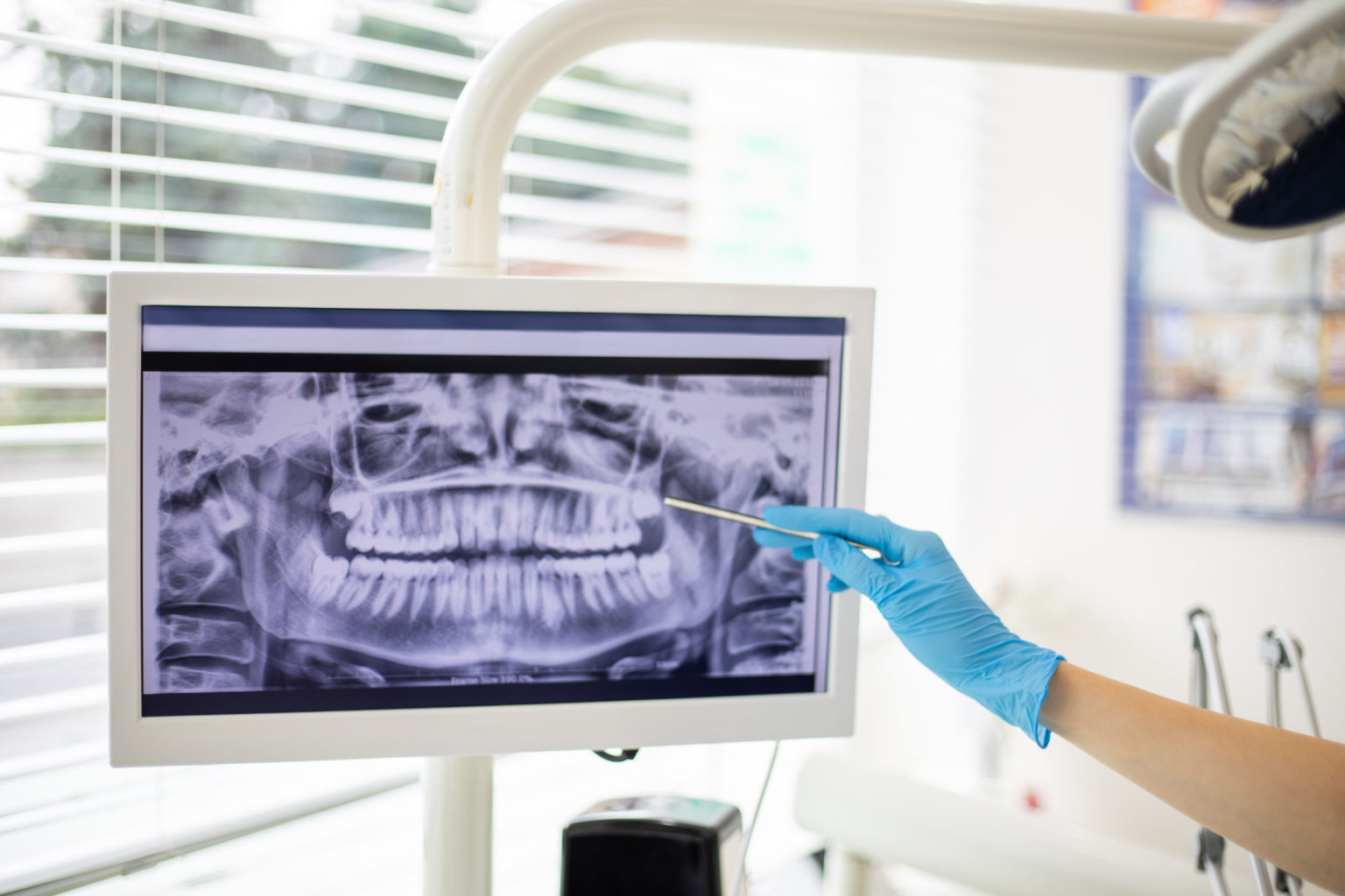 Are Dental X Rays Safe White Plains Dental® White Plains Ny