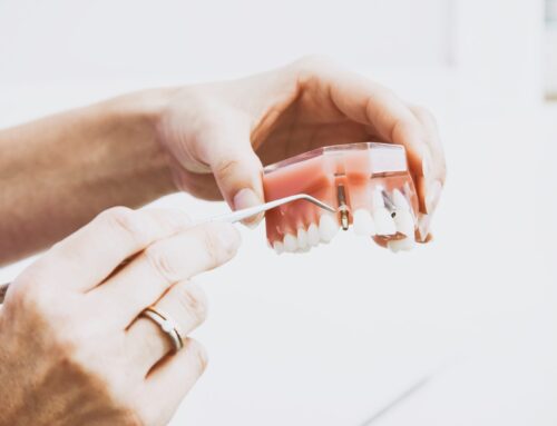 Dental Implant Procedure: What to Expect